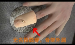 运动强度太大   把娃干坏了怎么办