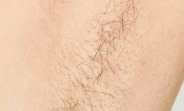 为啥不建议给硅胶娃娃植腋毛？