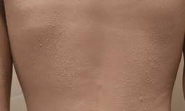 这种点点该怎么清理