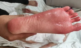 悦互动娃娃155分体开箱兼叙事