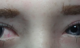 冬天吃香菜085娃娃美瞳