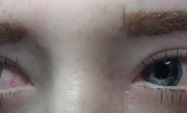 冬天吃香菜085娃娃美瞳