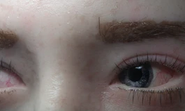 冬天吃香菜085娃娃美瞳