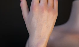 色系娃娃优化全新骨架【优化麻花手问题】