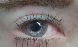 冬天吃香菜093款美瞳眼