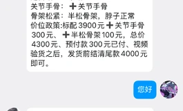 急出butterfly 150