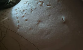 天塌啦！密集恐惧症慎入！1