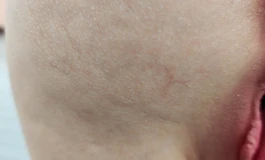 【硅胶10斤臀模】