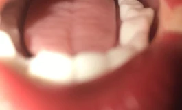 完美炮架，开口头+tpe半身