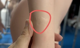 轻微出厂硅胶身体瑕疵