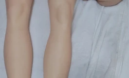 出腿模