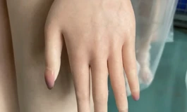 出厂硅胶体瑕疵