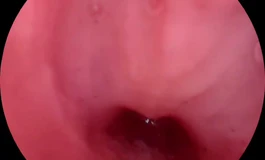 突发奇想买了个内窥镜，玩偶姐姐臀模有重大发现！！！